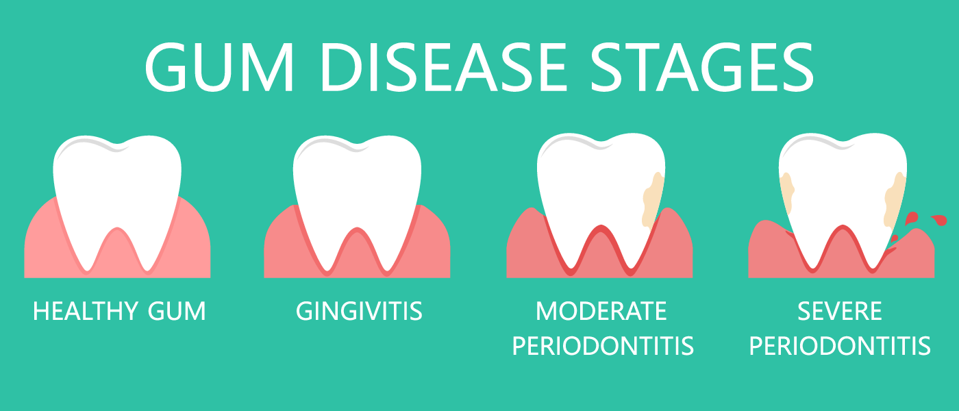 What Do Healthy Gums Look Like Arm And Hammer™