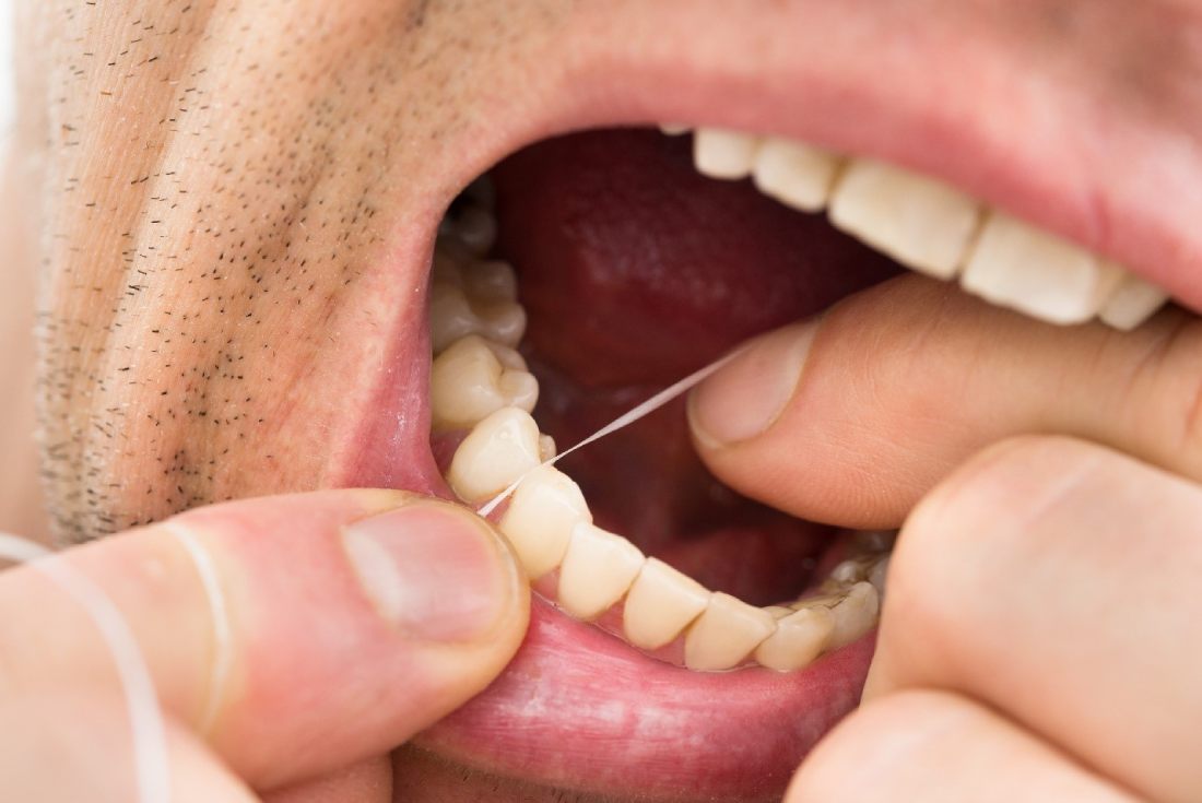 Man flossing teeth to prevent black tartar on teeth
